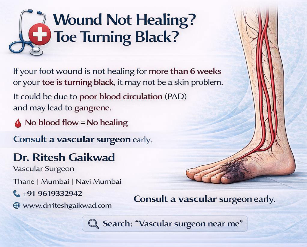 Dr. Ritesh Gaikwad Vascular surgeon and Endo Vascular surgeon