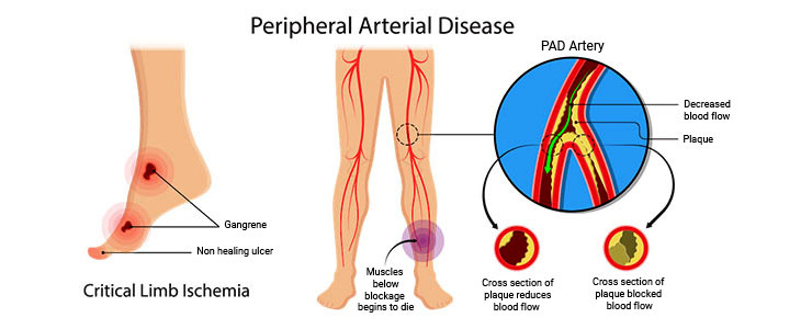 Dr Ritesh Gaikwad Vascular Surgeon, Ghodbunder Road, Thane