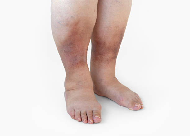 best gangrene specialist doctor in mulund