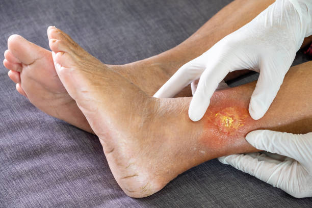 Best Gangrene Specialist Doctor in Thane