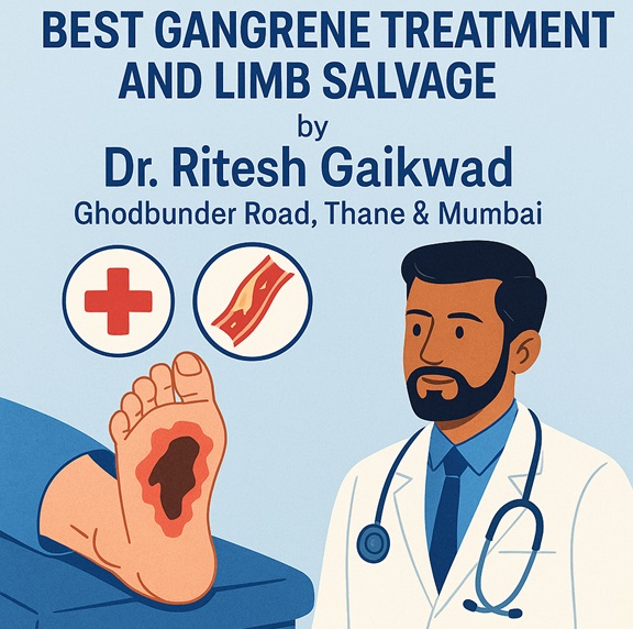 Best Gangrene Treatment and Limb Salvage by Dr. Ritesh Gaikwad, Ghodbunder road, Thane & Mumbai