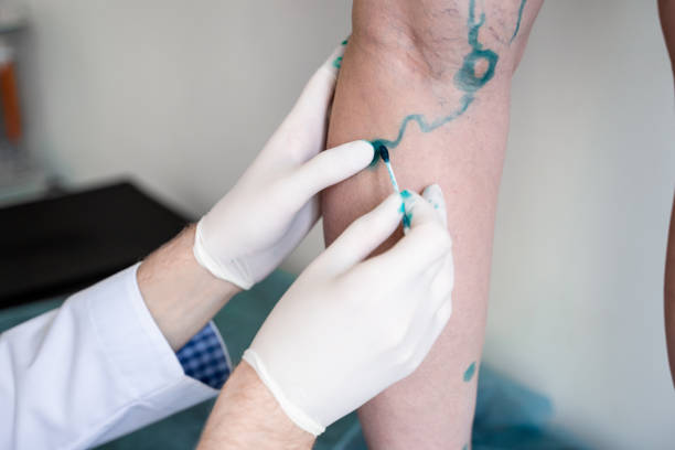 Best Vascular Surgeon in Vikroli