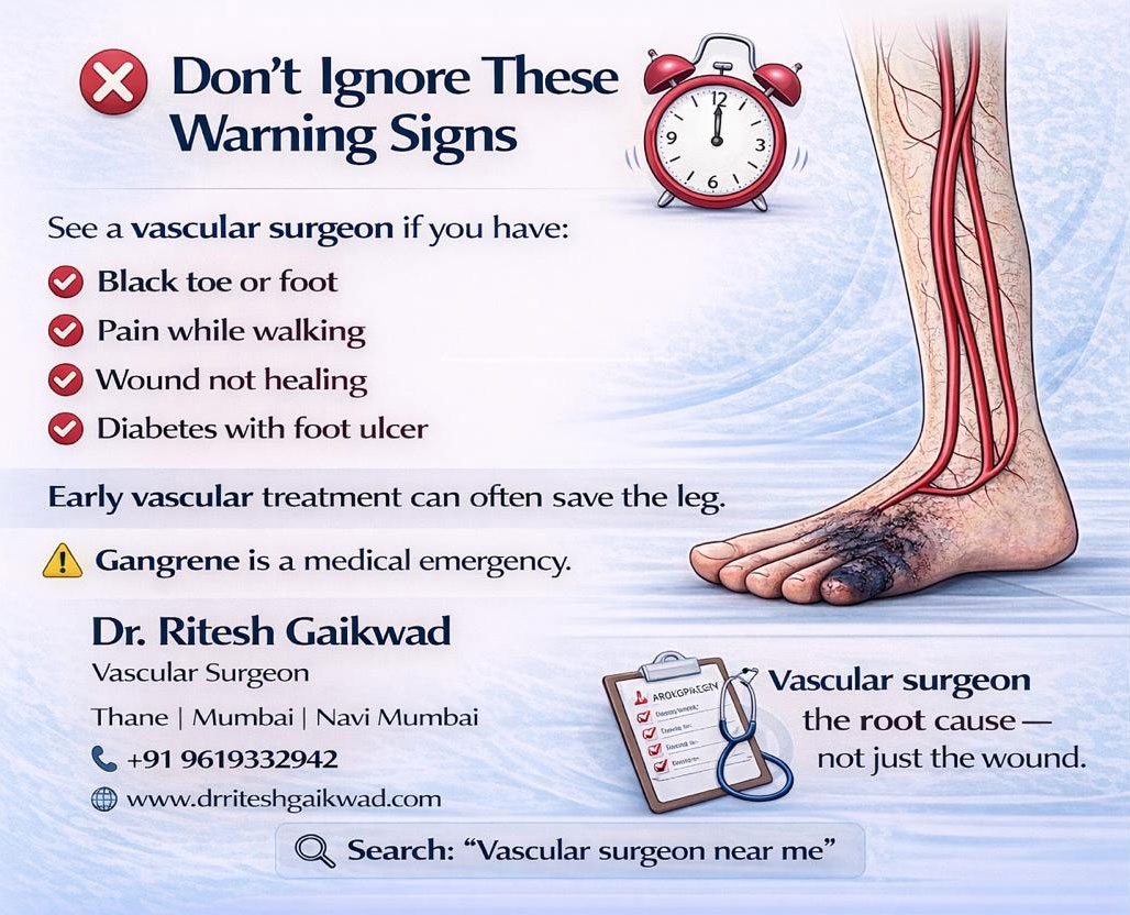 Dr. Ritesh Gaikwad Vascular surgeon and Endo Vascular surgeon