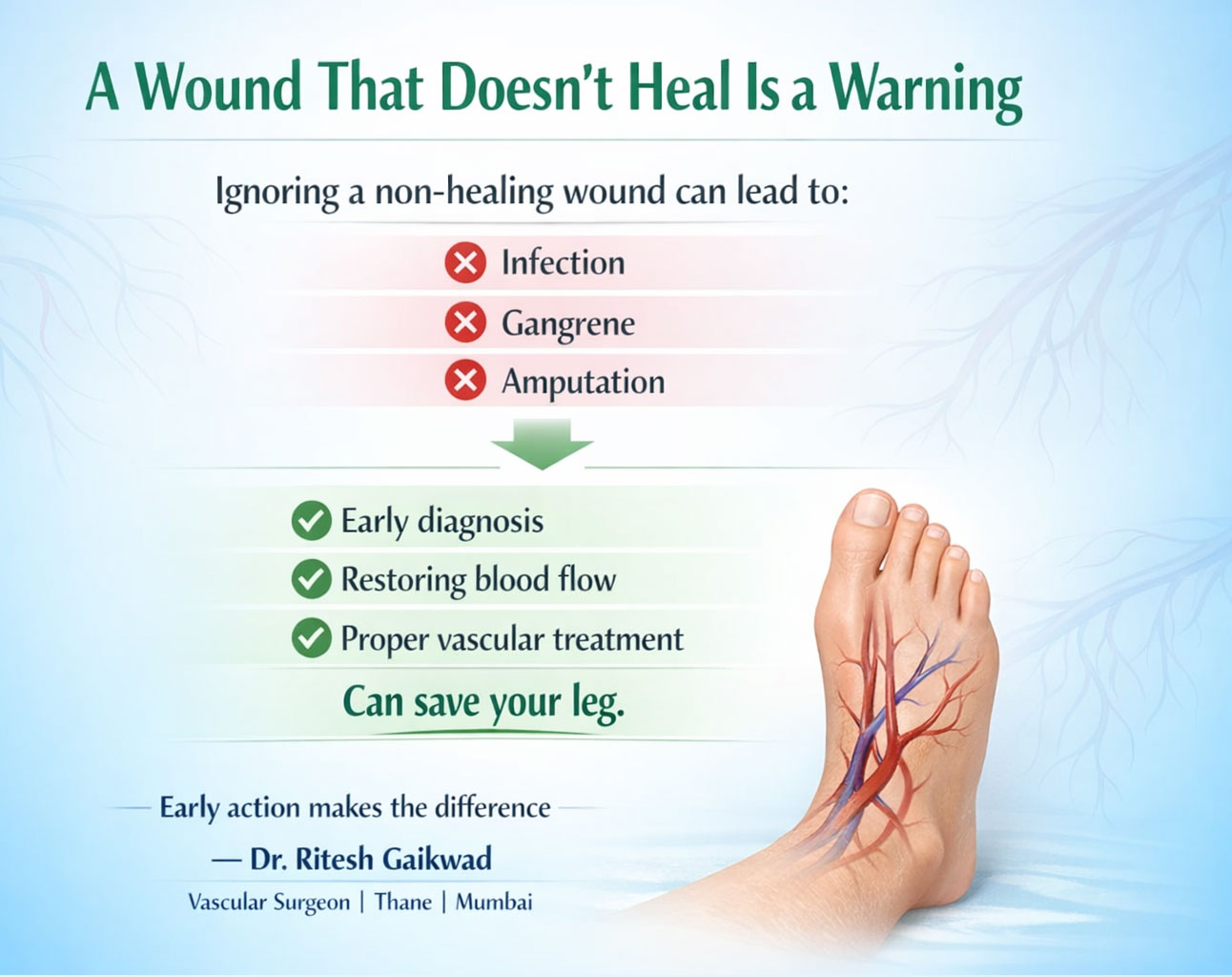 Dr. Ritesh Gaikwad Vascular surgeon and Endo Vascular surgeon